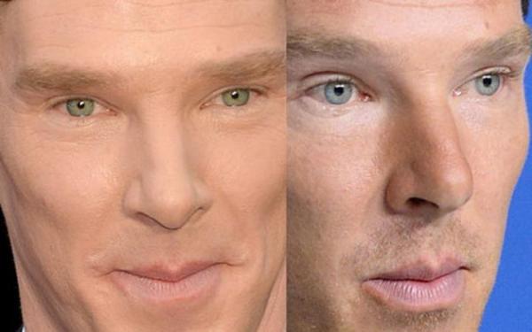 benedict-cumberbatch-eyes-sectoral-heterochromia-large